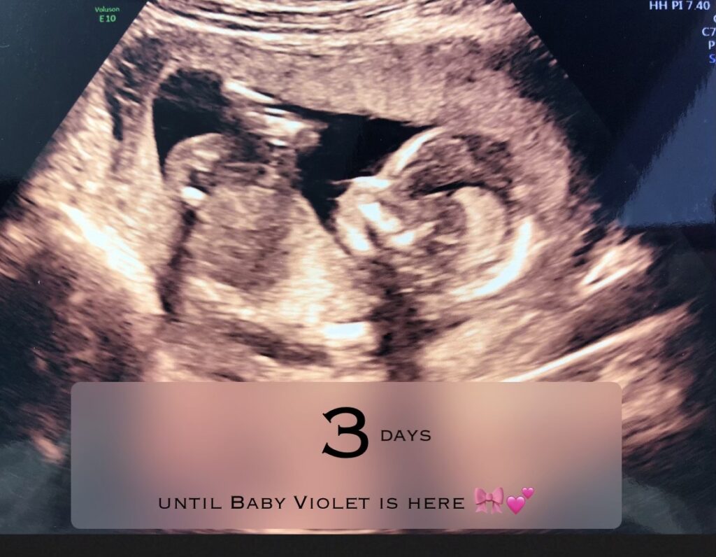 Latest Baby V Update