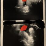 I got to go to Violets Sonogram